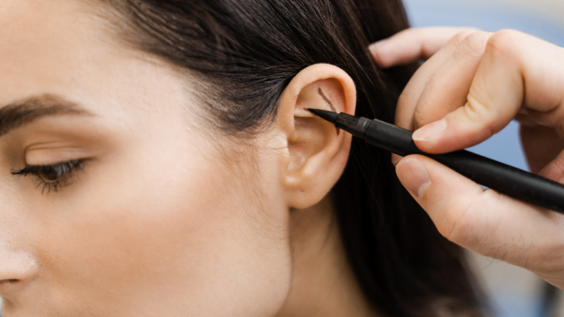 Otoplastia e cuidados no pós-operatório das orelhas proeminentes com Dr. Haeckel Cabral.